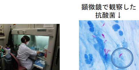 抗酸菌検査