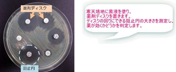 薬剤感受性検査