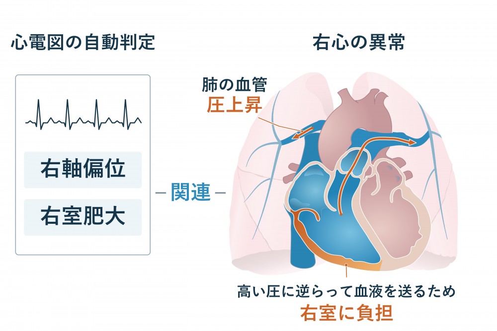 心臓の図1