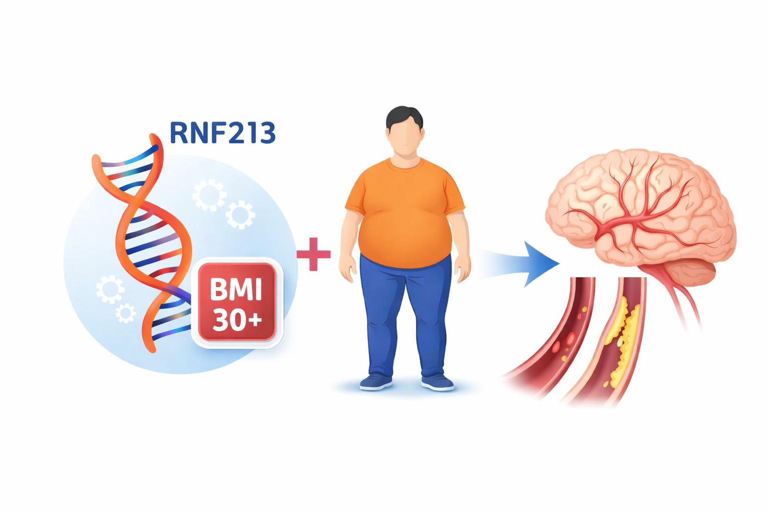 &ldquo;RNF213 p.R4810K Variant and Intracranial Atherosclerosis: Increased Risk in Obese Variant Carriers&rdquo; Tetsuro Ago (Medicine and Clinical Science), Kuniyuki Nakamura and Takuya Kiyohara (Kyushu University Hospital)