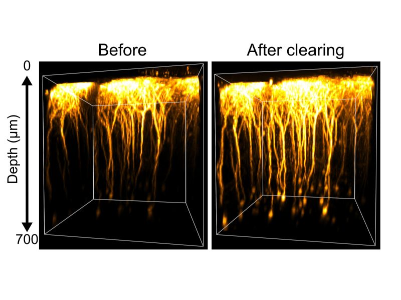 &ldquo;Isotonic and minimally invasive optical clearing media for live cell imaging ex vivo and in vivo&rdquo; Takeshi Imai and Shigenori Inagaki (Developmental Neurophysiology)