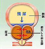 �O���B���ǂ̑O���B