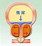 ���Ւf��̍�p�@��